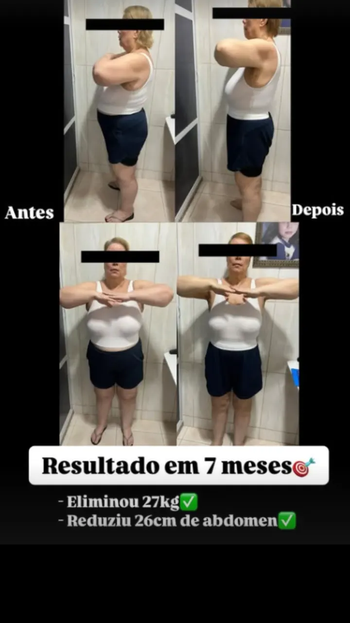 Transformação de paciente: antes e depois